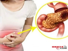 Pankreatiti olan xəstələrə bu qidalar olmaz – QADAĞAN SİYAHISI