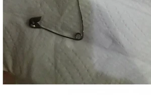 Bakıda dəhşət: qadın zavod çörəyinin içindəki sancağı uddu – “İki dövlət xəstəxanası anama kömək edə bilmədi”