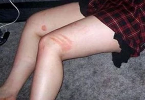 Şəhərin mərkəzində dəhşət: Qadını zorlayıb, çılpaq qoyub qaçdı