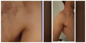 Azərbaycanda BİABIRÇILIQ - Gənci soyundurub kafenin qarşısına atdılar - FOTOLAR