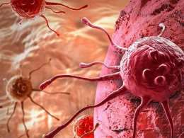 Xərçəng sahəsində mütəxəssis olan və dünya tərəfindən tanınmış adlar, xərçəngin yaxında soyuqdəymə kimi bir xə