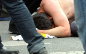 Gənc oğlanı döyüb çənəsini qırdılar