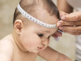 Körpələrin baş ətrafını mütləq ölçdürün - Hidrosefaliya TƏHLÜKƏSİ