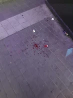 "Tarqovıy" da dəhşət: Gəncin üzünə lezva çəkdilər + FOTO