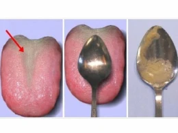 60 saniyəlik sağlamlıq testi: Sizə yalnız çay qaşığı lazım olacaq