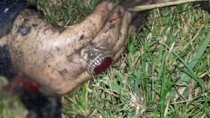 Generalın anbaan öldürüldüyü görüntü təkcə əli qalıb - VIDEO