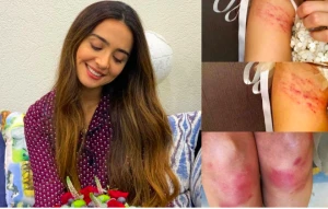 Azərbaycanda məşhur aparıcını bu hala saldılar – Bədənin hər yeri… – FOTOLAR