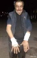 Bakıda canavar 54 yaşlı kişiyə hücum etdi - FOTO