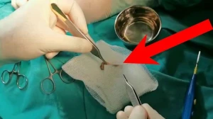 Azərbaycanda sünnət zamanı uşağın cinsiyyət orqanı kökündən kəsildi - ŞOK VİDEO