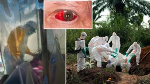 Dünya şokda! Koronovirusdan da dəhşətli yeni xəstəlik yayıldı 