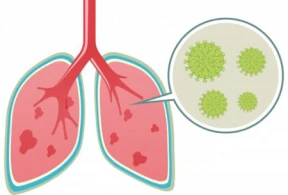 Ağciyəri koronavirusdan qorumaq üçün hər səhər bu məhsulu yeyin