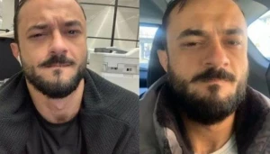 Koronavirusa yoluxan azərbaycanlı gənc: "Heç vaxt belə ağrı hiss etməmişəm"