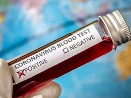 Rus yazıçıdan sensasiya: Koronavirus yoxdur, məqsəd...