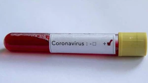 Koronavirus hava yolu ilə yoluxur? - AÇIQLAMA