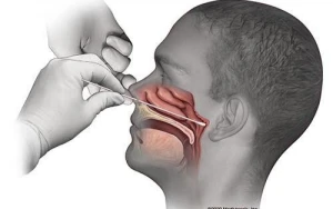 Koronavirus analizi belə götürülür – Ağrılı prosesdir