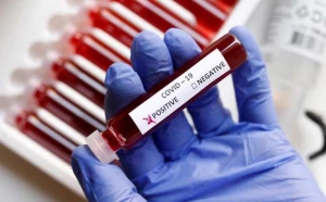 Çinin yardım üçün göndərdiyi testlərdə koronavirus aşkarlandı