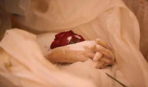 Koronavirusdan ölən şəxslərin əli bu hala düşür... — FOTO