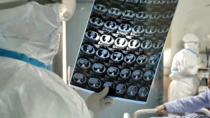 İsveçli həkimdən koronavirusla bağlı DƏHŞƏTLİ PROQNOZ