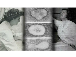 ŞOK: Koronavirusu illər əvvəl yaşayan bu xanımla nə bağlayır?