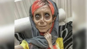 Sosial media fenomenindən ACI XƏBƏR