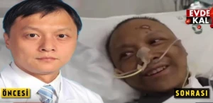 Dünya ŞOKDA! Koronavirusa yoluxan ağ dərili həkim qaraya döndü (18+VİDEO)