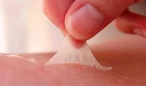 COVID-19 daha 5 xəstəliyə səbəb olur - ŞOK ARAŞDIRMA