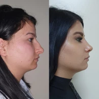 Plastik cərrah Sənan Mehdiyevin əməliyyatda yenilikləri +VİDEO