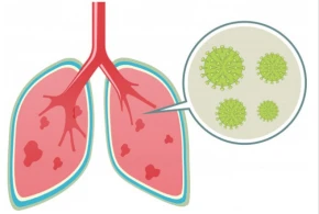 Ağciyəri koronavirusdan qorumaq üçün hər səhər bu məhsulu yeyin