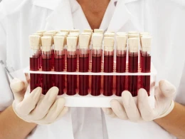 Koronavirus xəstələrinə qan lazımdır