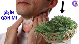 Şüyüd bu xəstəliyin dərmanıdır - RESEPTİ