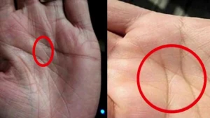 Ovucunuzun ortasında “X” işarəsi var? - Deməli siz...