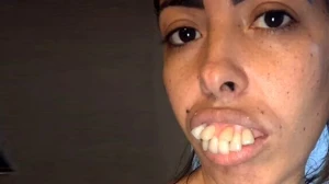 Bu qadının necə dəyişdiyini görüncə inanmayacaqsız - Şok görüntü