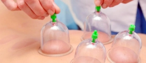 Ürəyində stent olanlar hicama və zəli qoya bilərmi ?(VİDEO)