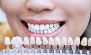 Dişlərimizi necə ağ saxlayaq? - Stomatoloqdan VACİB MƏSLƏHƏTLƏTR