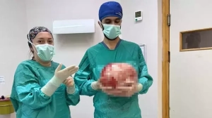 Hamilə bildikləri qadının qarnından görün nə çıxdı&nbsp; - FOTOLAR&nbsp;