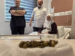 Yaşlı qadının ödündən 213 ədəd daş çıxdı&nbsp; - FOTO