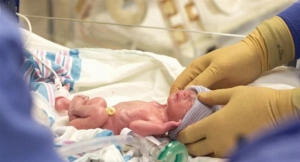 Vaxtından əvvəl doğulan uşaqlarla bağlı vacib AÇIQLAMA&nbsp;