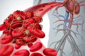 Bu qidanı yeyən kimi QAN LAXTALANIR - İnsanlardan nəyi gizlədirlər?