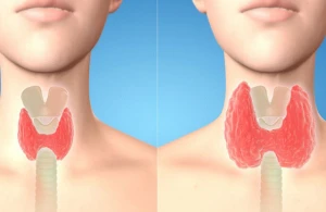 Zob niyə böyüyür?