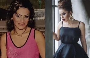 Rəqsanənin plastik əməliyyatdan əvvəlki halı - ARXİV&nbsp; FOTOSU YAYILDI&nbsp;