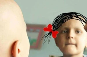 Uşaqlarda xərçəng nədən yaranır?—&nbsp; Onkoloq valideynlərin BİLMƏLİ OLDUĞU FAKTLARI AÇIQLADI