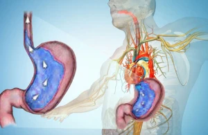 Mədə ilə ürək ağrısını necə seçək?&nbsp; —&nbsp; &nbsp;Bu yolla ayırd etmək mümkdündür