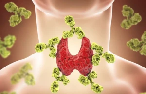 Haşimoto xəstələri nə yeməlidir?