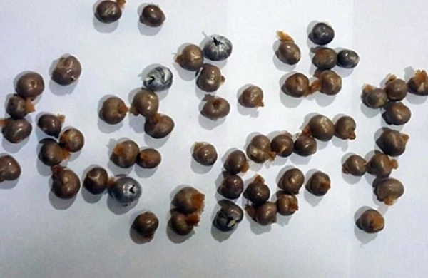 Qadının cinsiyyət orqanından narkotik çıxdı -  Azərbaycanda