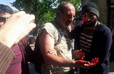 Polis erməni deputatı döyüb xəstəxanalıq etdi - FOTO