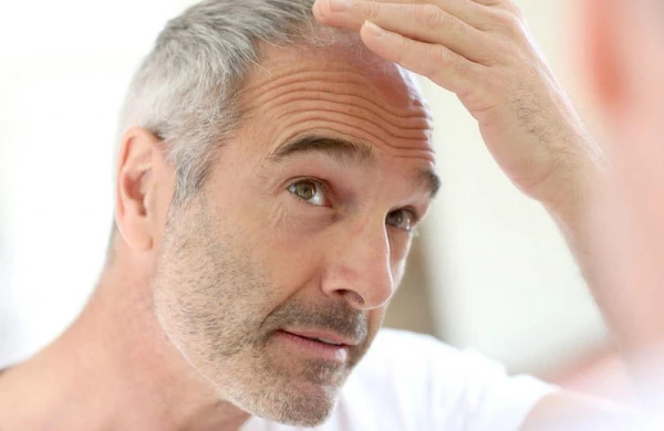 Saçı tez ağaran adamları bu təhlükə gözləyir