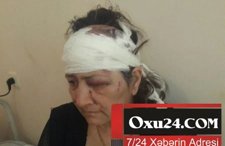 Azərbaycanda qayınana kürəkəni tərəfindən döyüldü