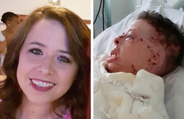 Сосед облил домохозяйку бензином, поджёг и с улыбкой смотрел, как она корчится –