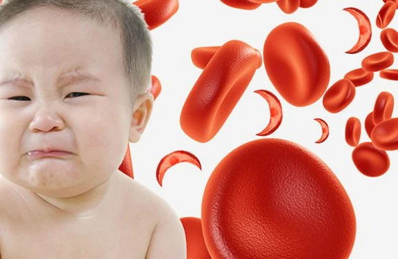 Qan azlığı olan uşaqlara bunları yedizdirin – PEDİATR SADALAYIR