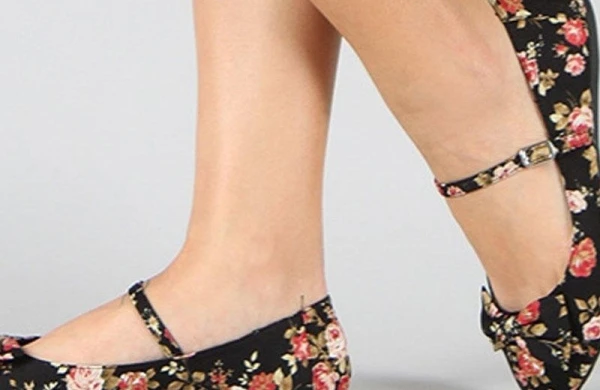 Xanımlar, diqqət: Babet ayaqqabıların bu qədər zərərli olduğunu bilmirdiniz